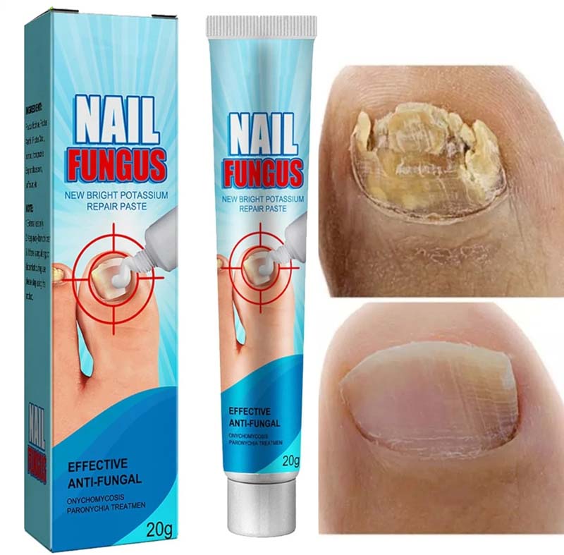 Reparador para Uñas Fungus