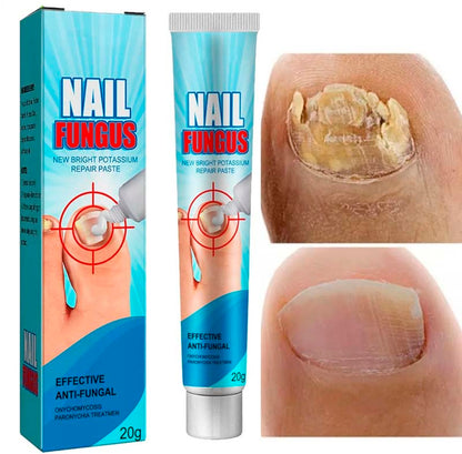 Reparador para Uñas Fungus