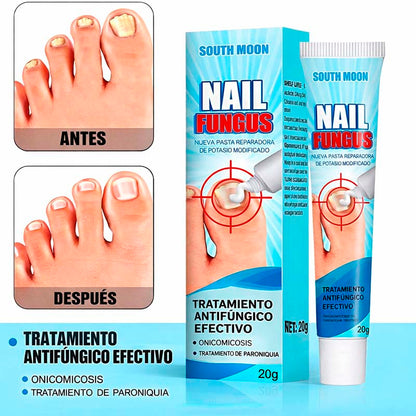 Reparador para Uñas Fungus