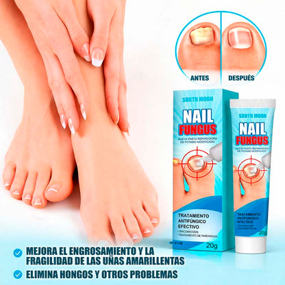 Reparador para Uñas Fungus