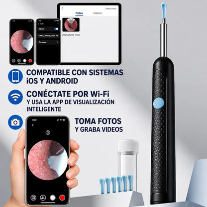 Kit inteligente de limpieza de oídos 👂✨