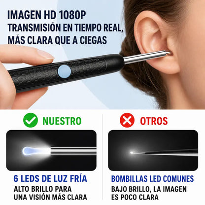 Kit inteligente de limpieza de oídos 👂✨