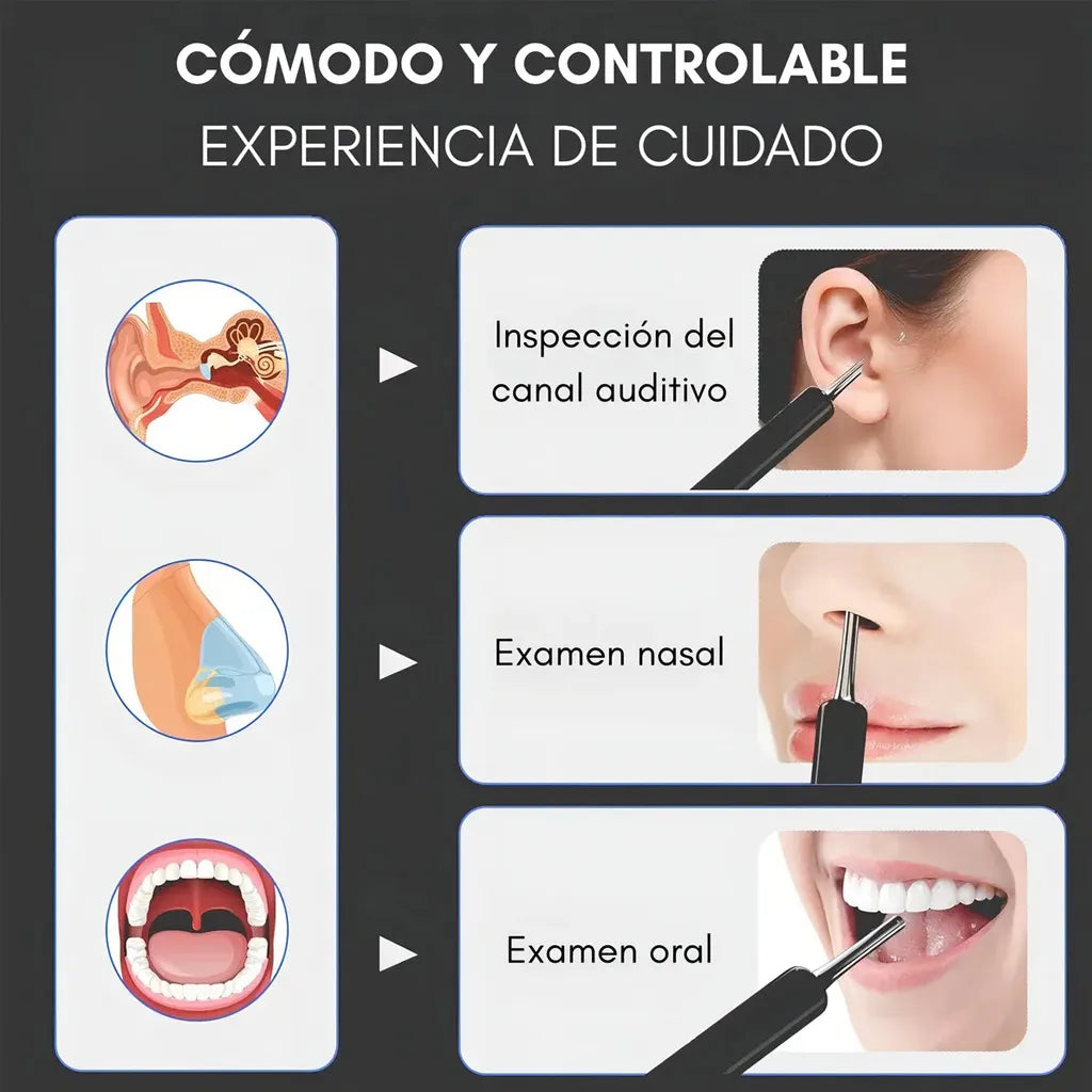 Limpiador de Oídos con Cámara HD y Luz LED