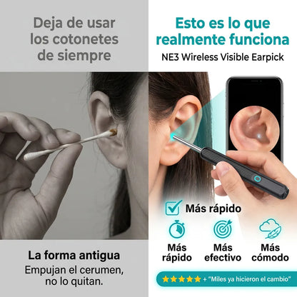 Limpiador de Oídos con Cámara HD y Luz LED